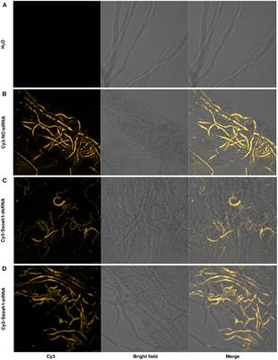 Host-Induced Gene Silencing of a Sclerotinia sclerotiorum oxaloacetate acetylhydrolase Using Bean Pod Mottle Virus as a Vehicle Reduces Disease on Soybean